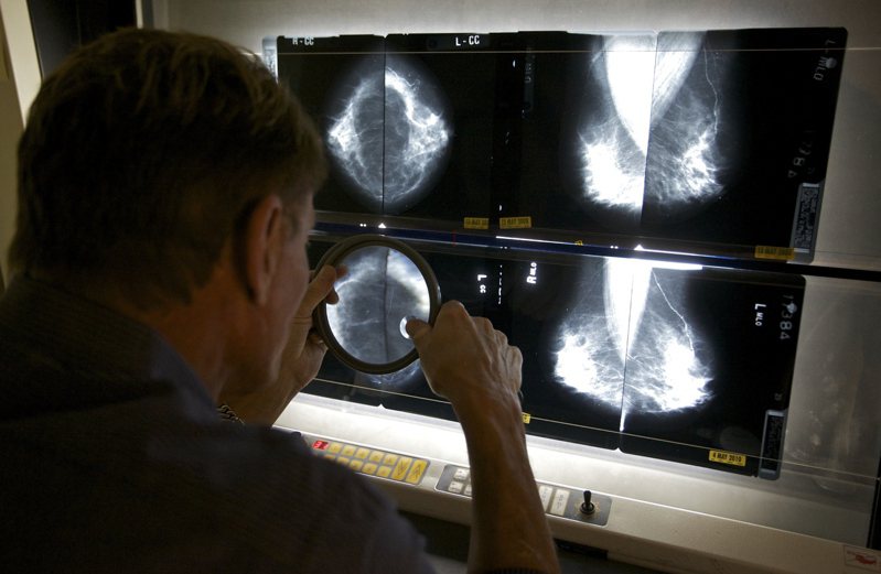 研究指出，美国癌症患者有年轻化趋势，尤其年軯女性患乳癌增加最快。(美联社)(photo:UDN)