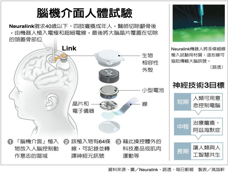 腦機介面人體試驗
製表╱高詣軒