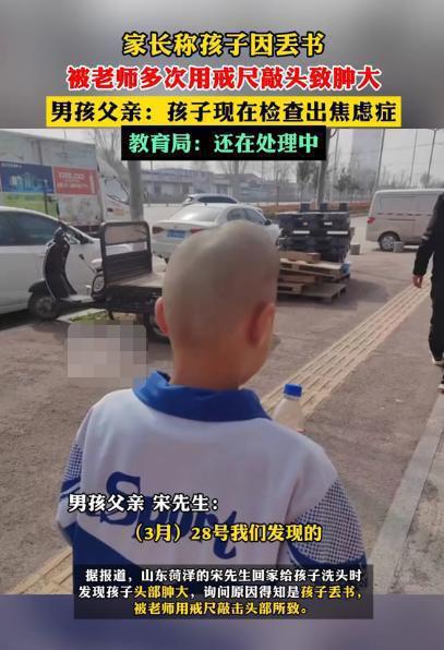 網曝山東一名小學三年級男生因丟失課本，遭老師用戒尺打頭，打得頭部嚴重變形。圖／取自影片